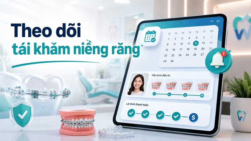 Quản lý ca niềng răng kéo dài: theo dõi buổi tái khám và tiền đóng theo đợt